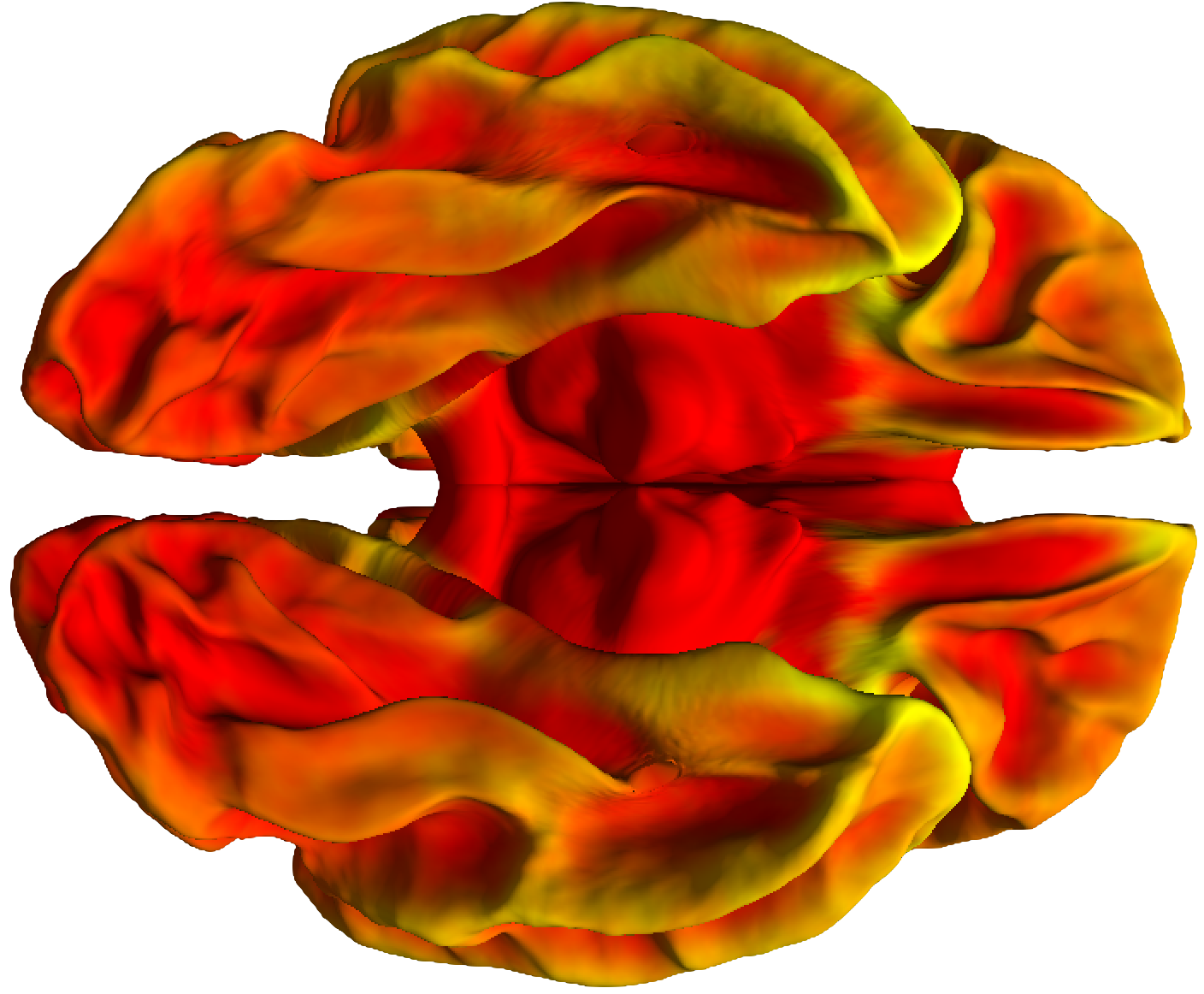 ventral view of a brain surface